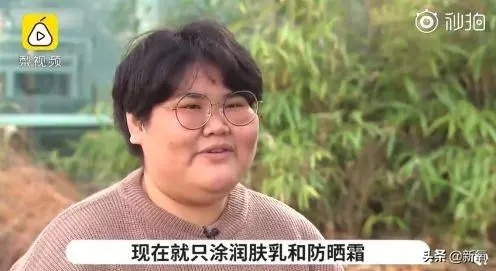 小狐狸腦袋卡垃圾桶蓋子上進出不得,等救援