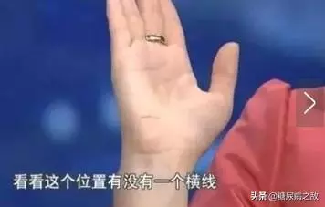 有沒有糖尿病,看手就知道,有這4個狀況,八成是糖尿病來了