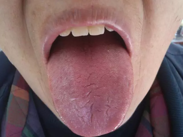 身上這個器官顏色越深,表明身體堵塞越嚴重,導致氣血不足,失眠!心血管疾病 纏身!!只要每天按這一穴位!血管通暢! ...