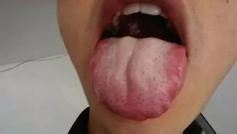 身上這個器官顏色越深,表明身體堵塞越嚴重,導致氣血不足,失眠!心血管疾病 纏身!!只要每天按這一穴位!血管通暢! ...