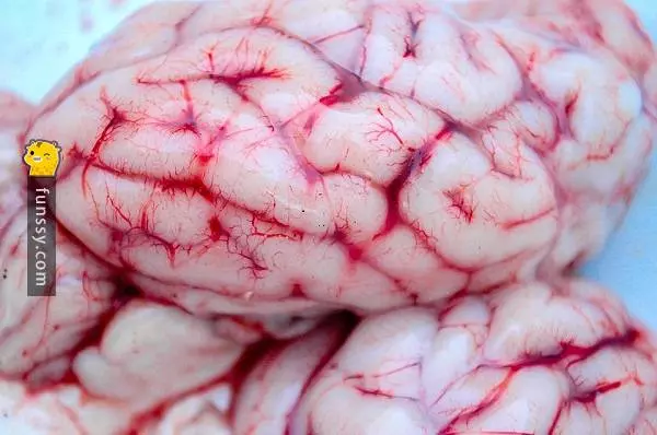 關於大腦的20個有趣事實~~~
