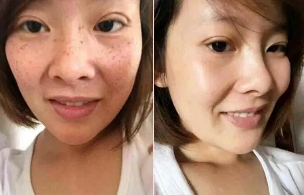 睡前用牙膏加點「它」擦臉,美白淡斑只需十幾分鐘,堅持一周恢復嬰兒肌!