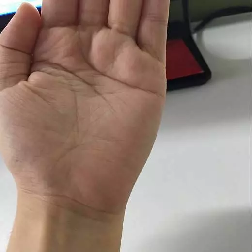 這條糖尿病線,你手上有沒有?不花一分錢,避免截肢、失明!!