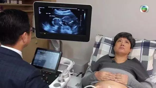 臨盆在即!前TVB男星52歲太太成功懷孕,卻慘遭咒罵:生出來養不大!