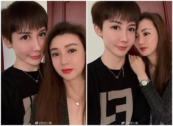蛇精男消失2年「全臉溶解」！無P[偷.拍]近照曝光「嚴重變形」…網友嚇：全毀了