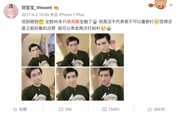 蛇精男消失2年「全臉溶解」！無P[偷.拍]近照曝光「嚴重變形」…網友嚇：全毀了