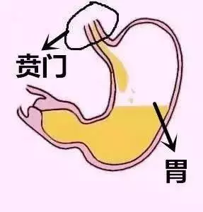 她得了怪病,很餓卻吃不下……醫生:發病率僅十萬分之一