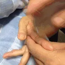 每天按摩小拇指50次,堅持一段時間,腰不疼、腿不酸了,連頭髮也烏黑了,不用去染髮