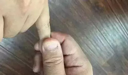 每天按摩小拇指50次,堅持一段時間,腰不疼、腿不酸了,連頭髮也烏黑了,不用去染髮