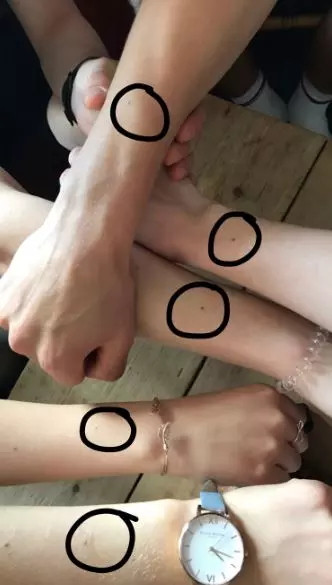 手腕這裡長痣!1萬多女生驚訝「我也有」 專家解釋:原因很單純