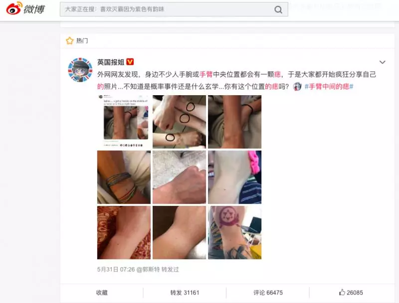 女生「這個地方」都有一顆痣? 網友伸手一看「還真的都有」驚呼:未免太詭異!