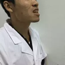 心臟不好的人,學會1套手指養心操,每天5分鐘,心臟年輕有活力!