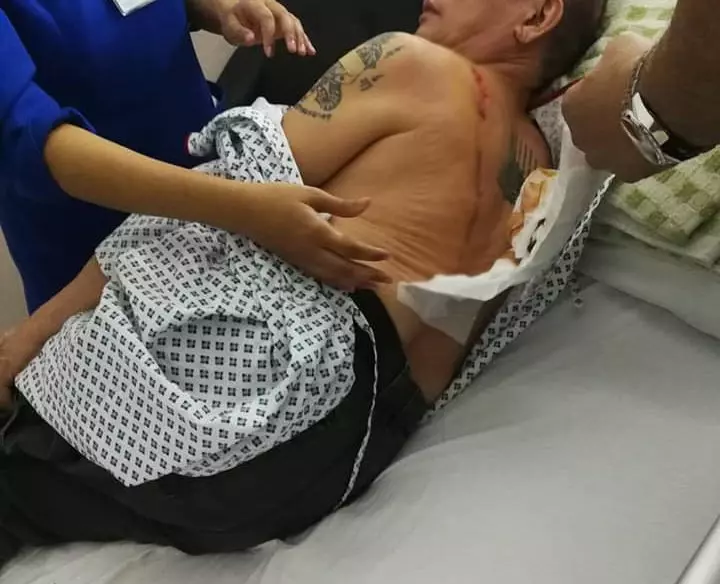 華裔男遭2摩哆匪掠奪 背部刀傷縫逾20針