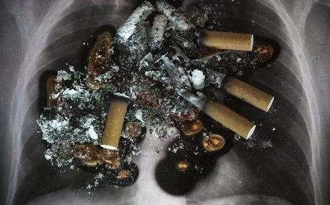 21 歲女孩查出癌症 5 天就死亡,手術都來不及!醫生 : 半年前就有徵兆
