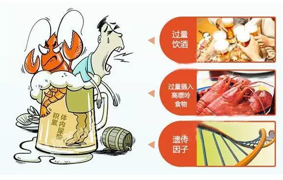 痛風病人注意:遠離幾件讓尿酸升高的事,從飲食到生活全面提醒你