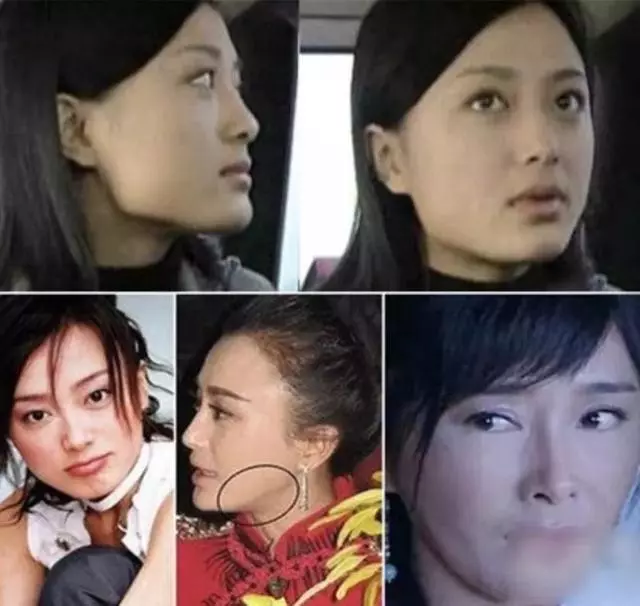 38歲秦嵐承認:靠醫美維持樣貌!「上鏡要瘦得像鬼」