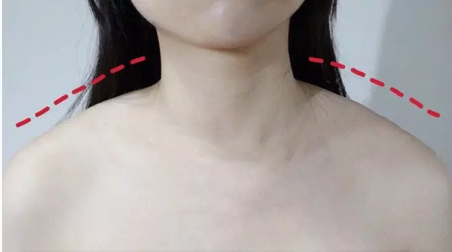 【瘦鎖骨】每天8分鐘瘦鎖骨操 無鎖骨、虎背熊腰視覺上肥10kg!
