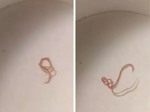 她PO網求助「馬桶驚見一堆扭曲紅色生物」用鹽酸都處理不了!專業網友:跟所有住戶都有關!