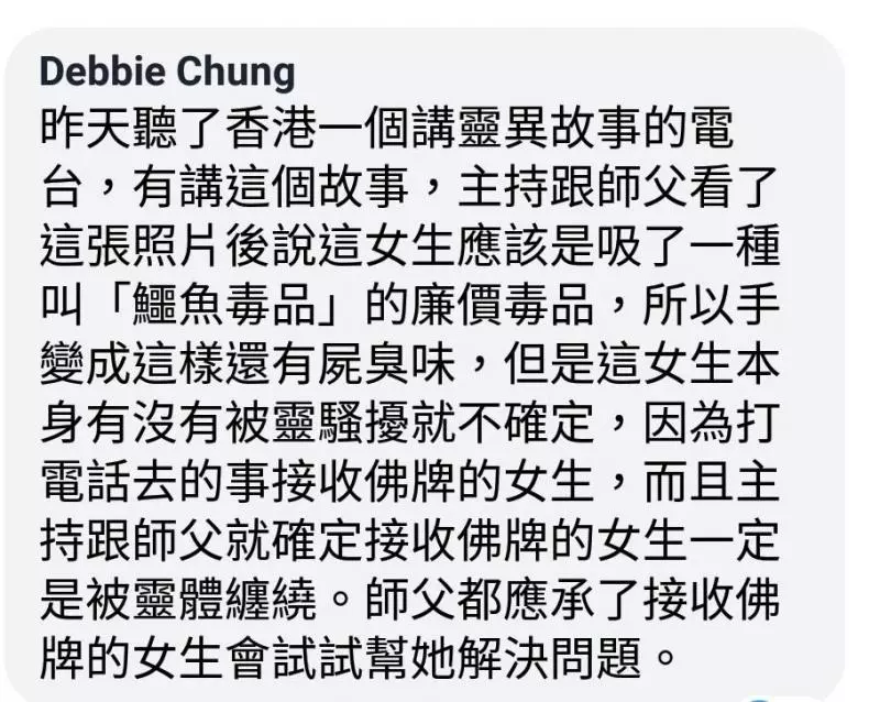 爆料公社 - 女子疑似被下蠱,驚見「鱷魚手」..網友眾說紛紜,真相竟然是...