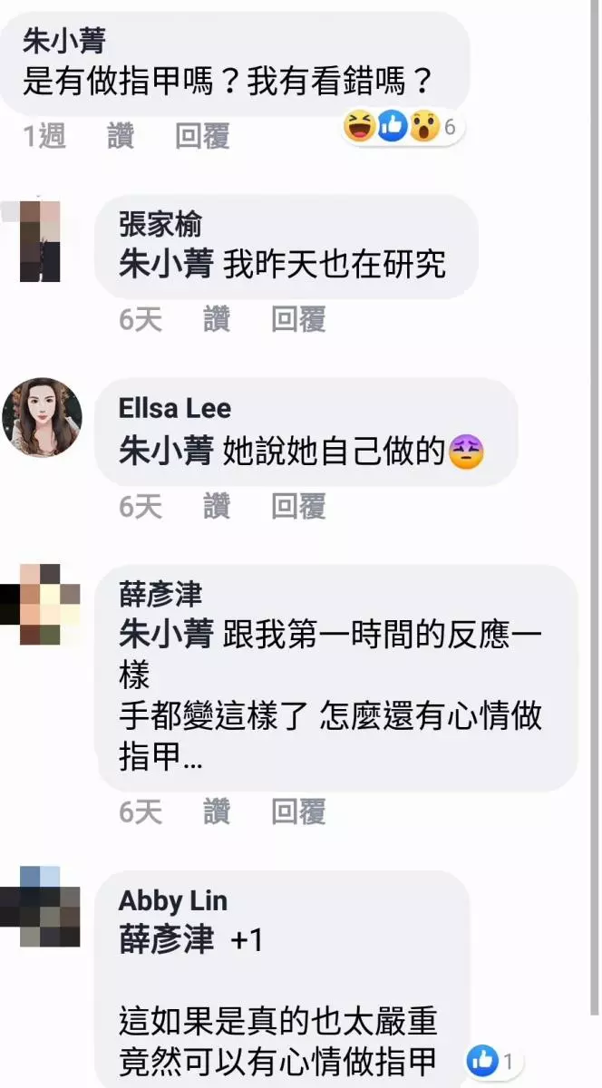 爆料公社 - 女子疑似被下蠱,驚見「鱷魚手」..網友眾說紛紜,真相竟然是...