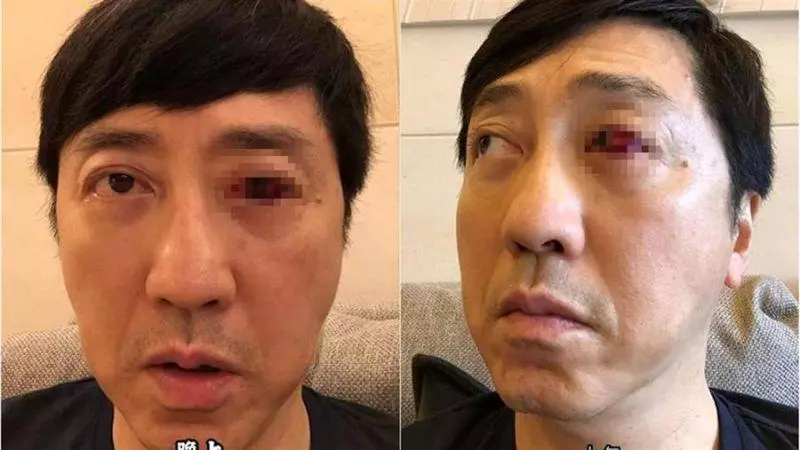 57歲庾澄慶健康亮紅燈!嚇人病情令人憂心