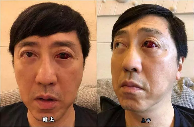 57歲庾澄慶健康亮紅燈!嚇人病情令人憂心
