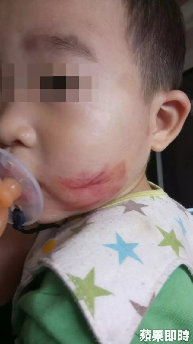 1歲童哭聲太吵 保母黏膠帶封嘴 健身教練掐臉
