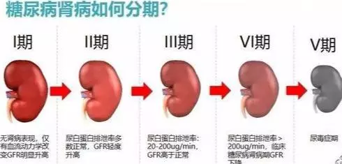 糖尿病腎病嚴重危害健康,早期篩查很重要!做好九點早預防