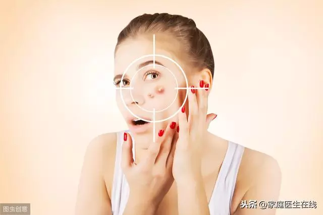 下巴長痘痘是怎麼回事?這6個位置長痘,都暗示不同健康問題