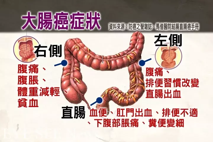 他跟賀一航一樣患「大腸癌3期」!毅然決然「做出關鍵選擇」結局大不同:態度決定一切