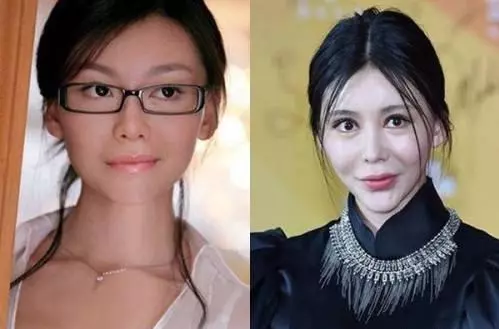 整容失敗有多可怕?看看這些娛樂圈女明星你就知道!