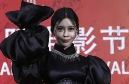 整容失敗有多可怕?看看這些娛樂圈女明星你就知道!
