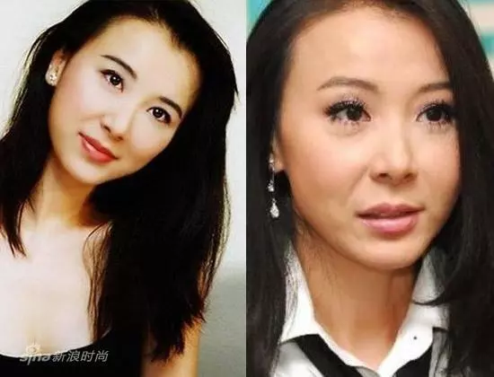 整容失敗有多可怕?看看這些娛樂圈女明星你就知道!