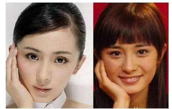 整容失敗有多可怕?看看這些娛樂圈女明星你就知道!