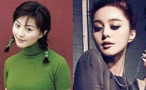 整容失敗有多可怕?看看這些娛樂圈女明星你就知道!