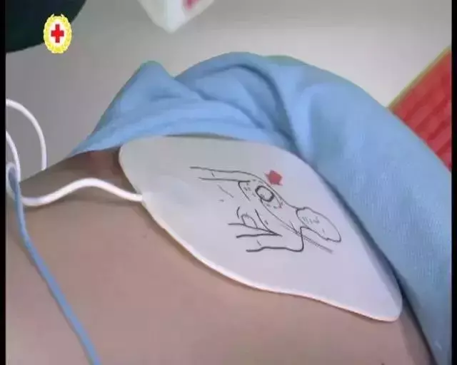 清華學生突發心臟驟停,"續命神器"再立大功!這招可救命!