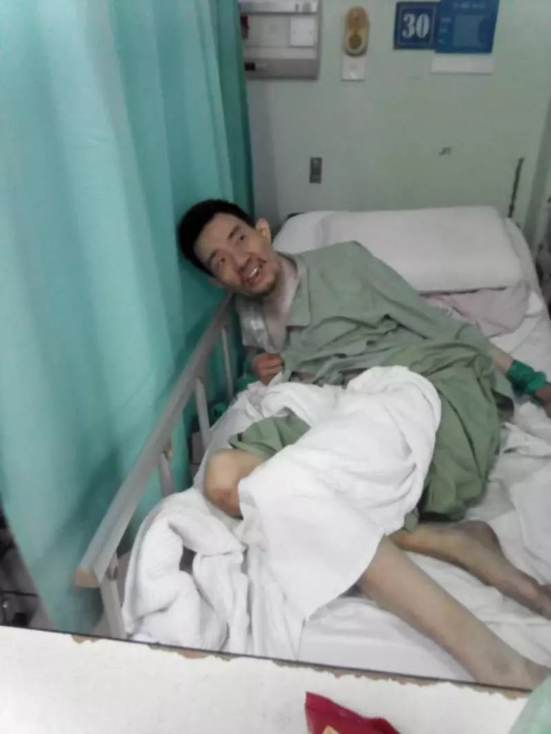 智障兒離不開媽媽 絕食9天後也走了