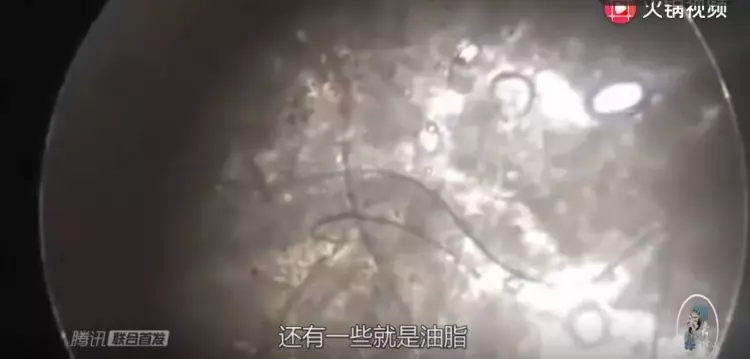 我們洗澡時搓下來的「鮮」到底是甚麼東西?在顯微鏡下放大100倍…瞬間解惑了!