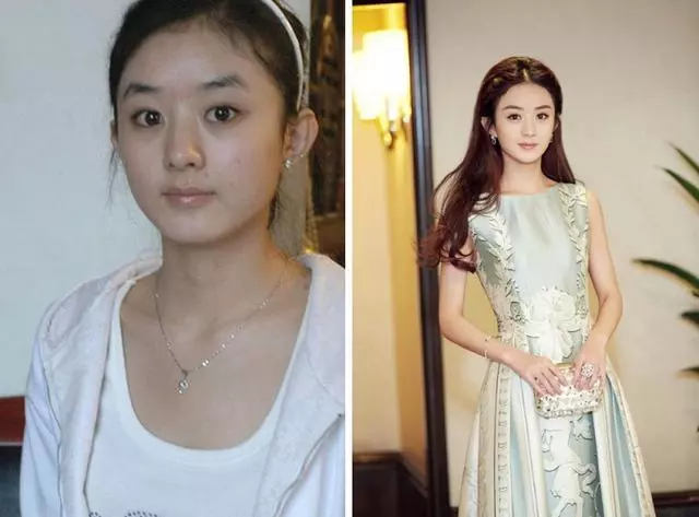 娛樂圈是座「整容院」!成名前和成名後明星顏值不斷逆襲,網友:關鍵在氣質
