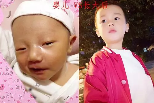 「章子怡的寶寶被嫌丑」其實剛出生的寶寶，這裡越丑，長大越好看