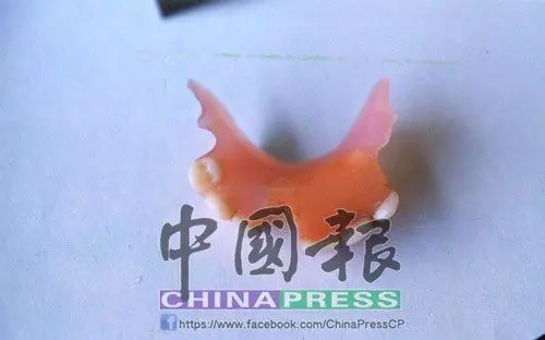 1993年 「一點紅」碎屍案