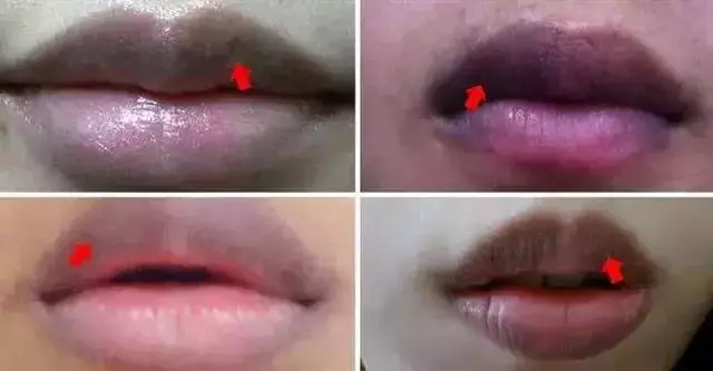 身體好不好,看嘴唇就知道,還能反映病變徵兆!