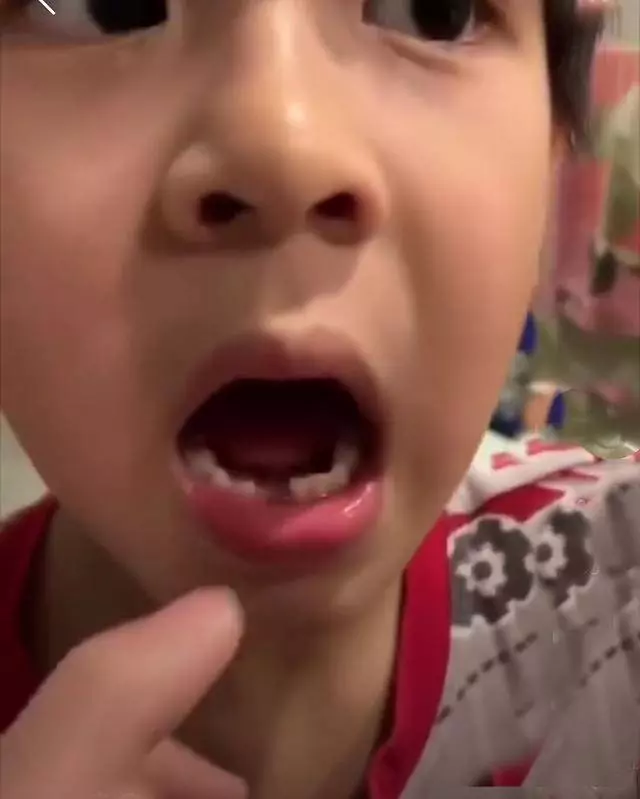 吳尊妻子能幹!親自給6歲Max拔牙,Max拔完牙沒哭好勇敢