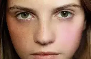臉色暗黃,經常發脾氣?多半是氣血出了問題,幾個妙方幫助你
