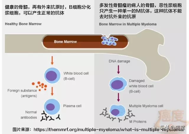 七十四歲老人抗癌五年的秘訣