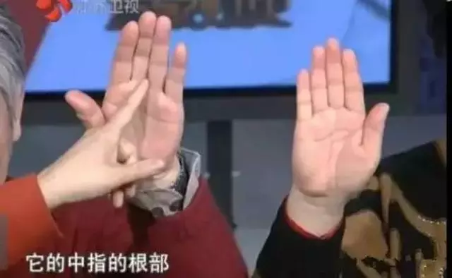 手上4個「信號」,警示你肝臟出問題了,養肝堅持三個好習慣