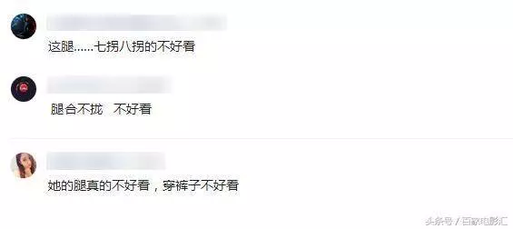 44歲林志玲出席活動近照,腿是怎麼了!,網友:腿合都合不攏,太難看了!