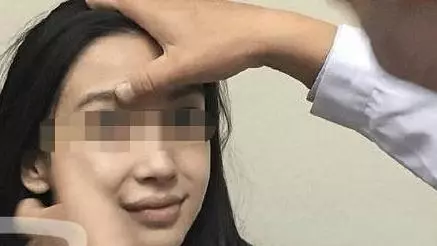 女子交50個男友,親了她後都選擇分手,去醫院醫生檢查後!.....