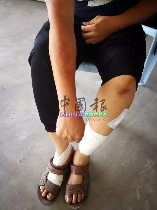 【救2幼童保母遭燒重傷不治】兒子說出偉大保姆感觸一面