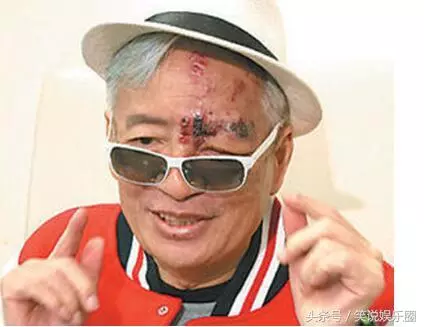 年輕時紅過費翔,娶過三個老婆有六個孩子,最終惹惱黑幫,被手槍打斷右腿!享年63歲....
